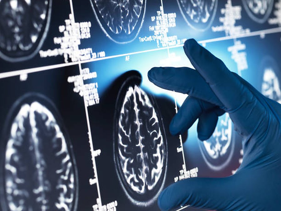 Memory and Neuro Health